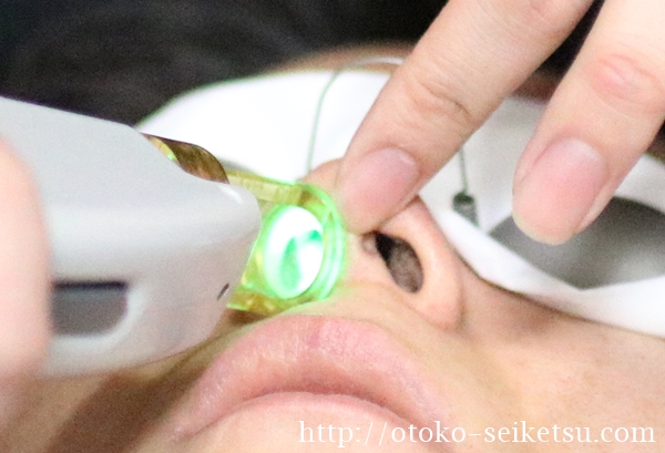 ゴリラクリニック鼻毛脱毛体験談４口コミ 経過も報告 男セイケツ Com